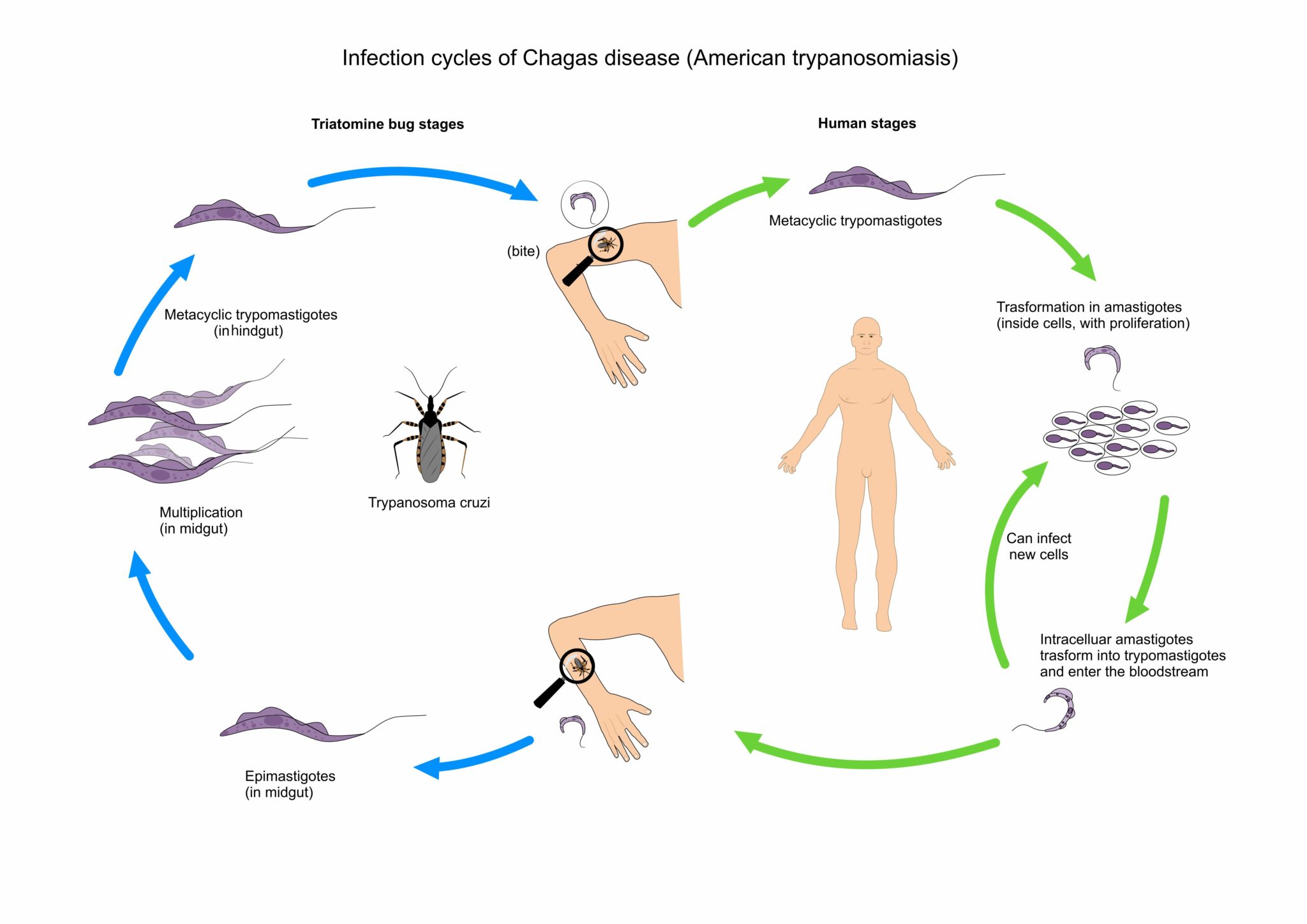 Chagas Disease - GIDEON - Global Infectious Diseases And Epidemiology ...