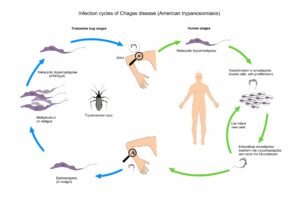 Chagas Disease - GIDEON - Global Infectious Diseases and Epidemiology