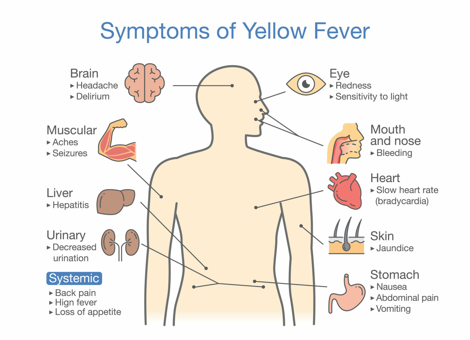 yellow-fever